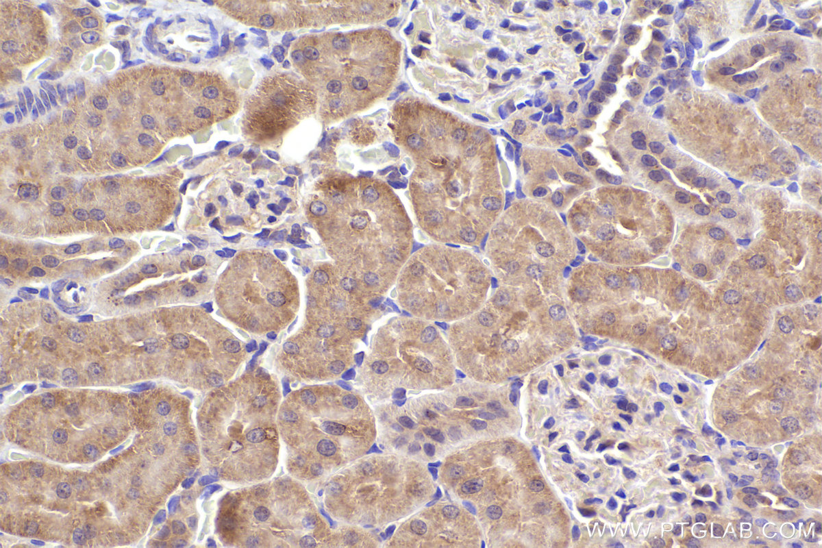 Immunohistochemical analysis of paraffin-embedded rat kidney tissue slide using KHC2391 (TAP2 IHC Kit).