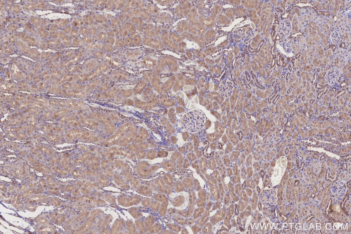 Immunohistochemical analysis of paraffin-embedded rat kidney tissue slide using KHC3203 (TARS IHC Kit).