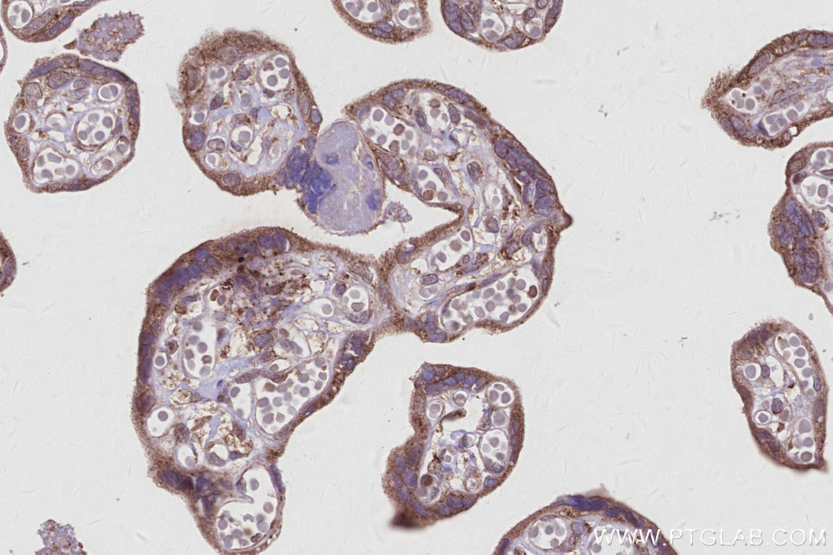 Immunohistochemical analysis of paraffin-embedded human placenta tissue slide using KHC2956 (TBC1D23 IHC Kit).