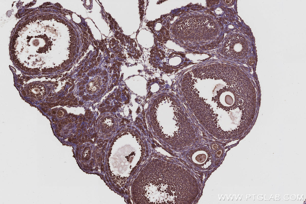 Immunohistochemical analysis of paraffin-embedded mouse ovary tissue slide using KHC2956 (TBC1D23 IHC Kit).