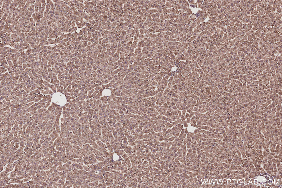 Immunohistochemical analysis of paraffin-embedded rat liver tissue slide using KHC2956 (TBC1D23 IHC Kit).