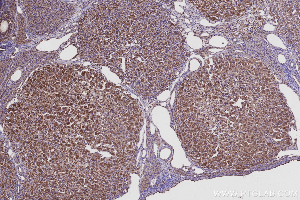 Immunohistochemical analysis of paraffin-embedded rat ovary tissue slide using KHC2956 (TBC1D23 IHC Kit).