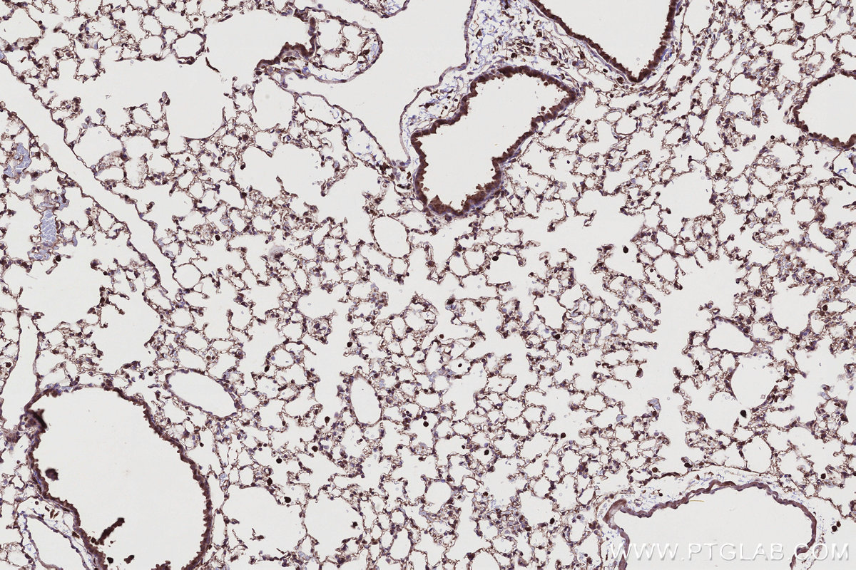 Immunohistochemical analysis of paraffin-embedded mouse lung tissue slide using KHC2748 (TBC1D5 IHC Kit).