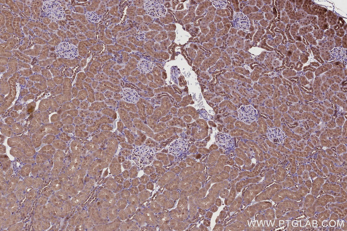 Immunohistochemical analysis of paraffin-embedded rat kidney tissue slide using KHC2748 (TBC1D5 IHC Kit).