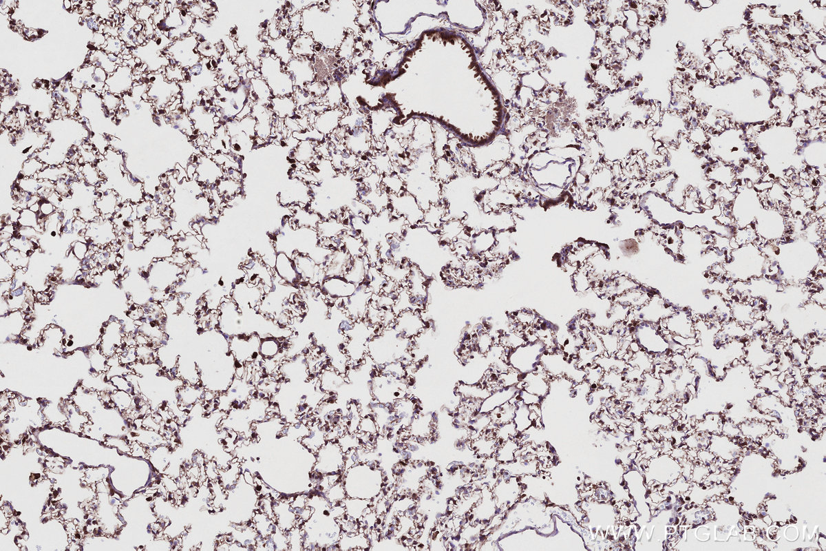Immunohistochemical analysis of paraffin-embedded rat lung tissue slide using KHC2748 (TBC1D5 IHC Kit).