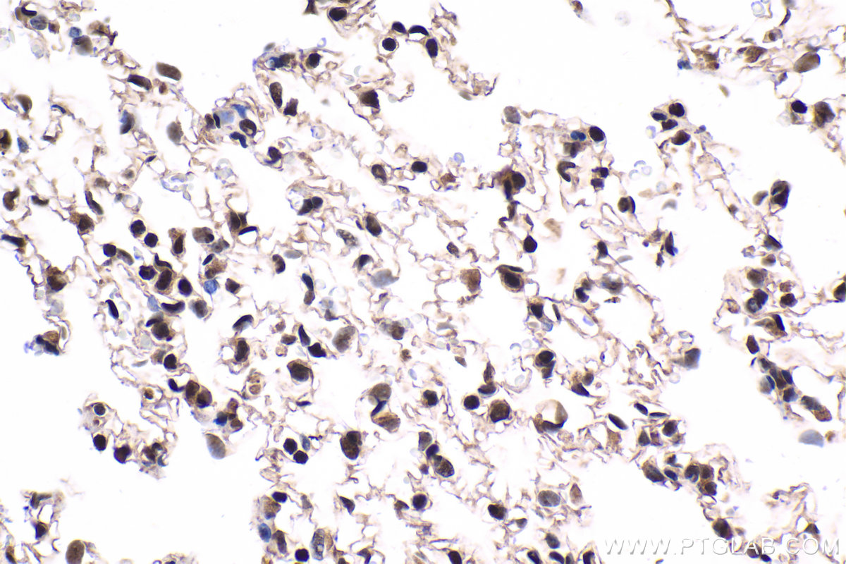 Immunohistochemical analysis of paraffin-embedded rat lung tissue slide using KHC1647 (TBPL1 IHC Kit).