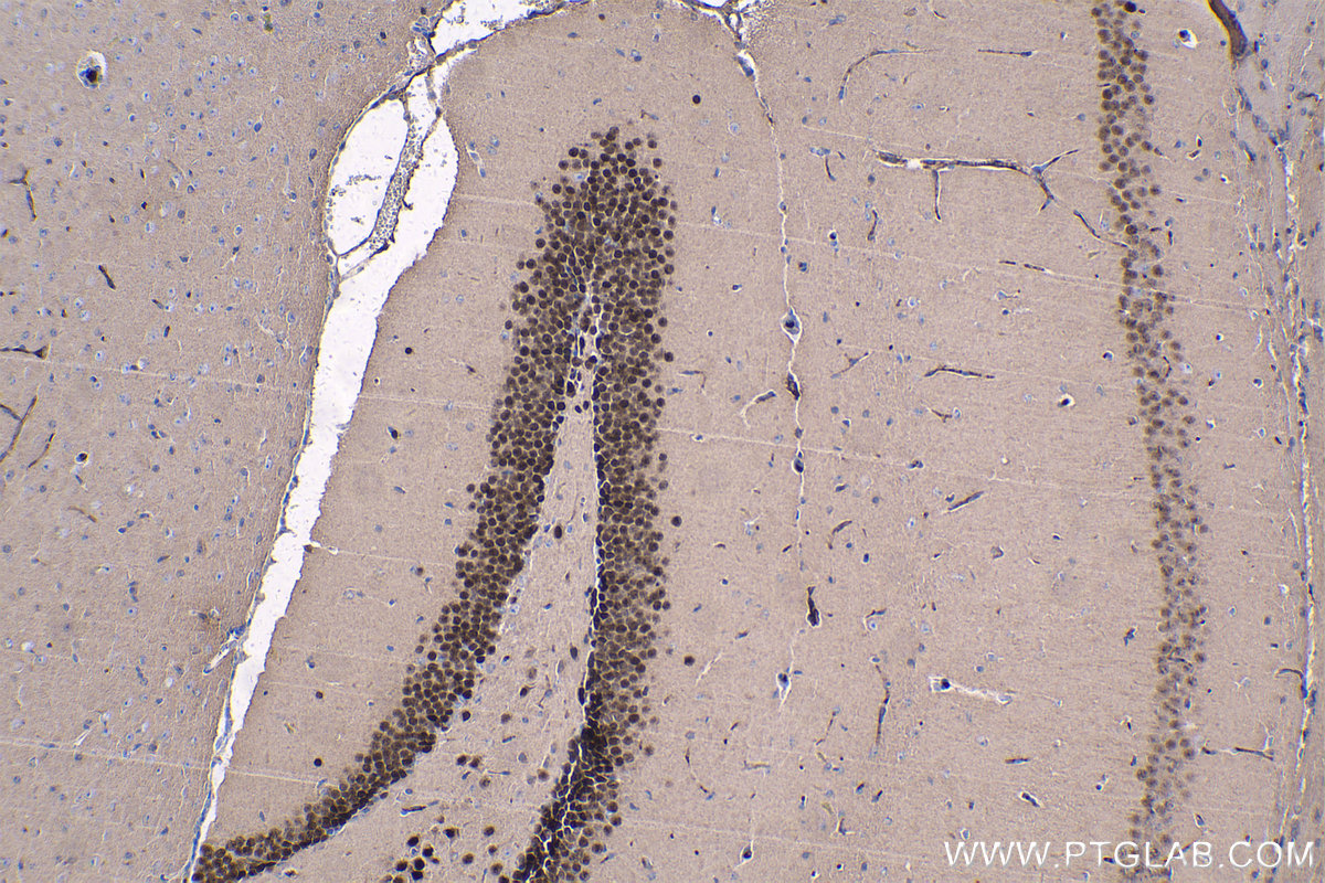 Immunohistochemical analysis of paraffin-embedded mouse brain tissue slide using KHC1338 (TBR1 IHC Kit).