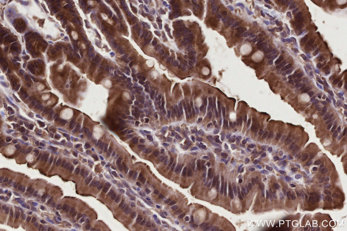 Immunohistochemical analysis of paraffin-embedded mouse small intestine tissue slide using KHC2774 (TBRG4 IHC Kit).