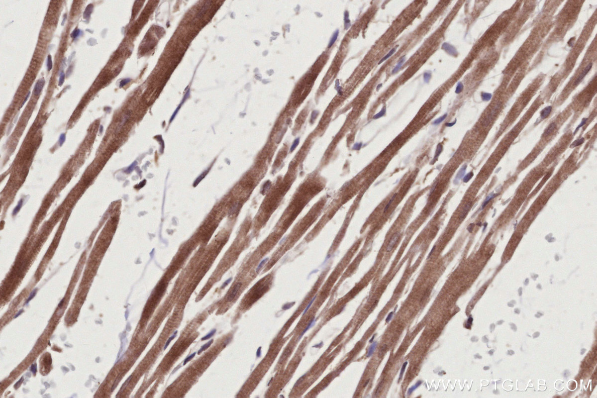 Immunohistochemical analysis of paraffin-embedded rat heart tissue slide using KHC2774 (TBRG4 IHC Kit).