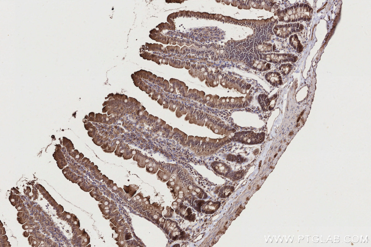 Immunohistochemical analysis of paraffin-embedded rat small intestine tissue slide using KHC2774 (TBRG4 IHC Kit).