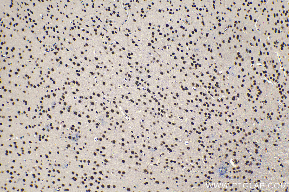 Immunohistochemical analysis of paraffin-embedded mouse brain tissue slide using KHC1428 (TCERG1 IHC Kit).