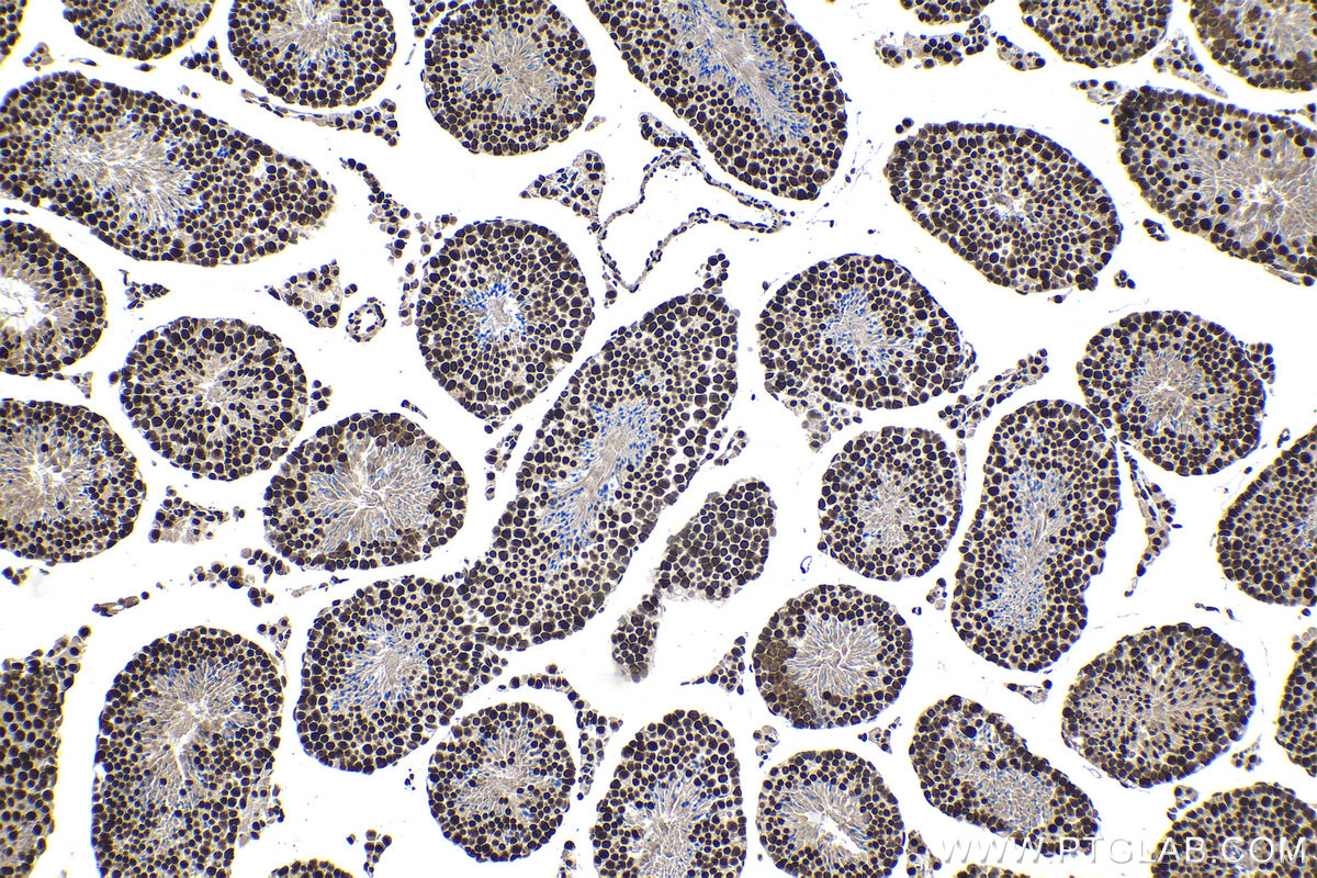 Immunohistochemical analysis of paraffin-embedded mouse testis tissue slide using KHC1428 (TCERG1 IHC Kit).