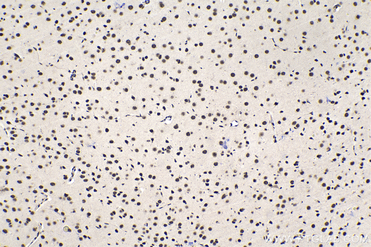 Immunohistochemical analysis of paraffin-embedded rat brain tissue slide using KHC1428 (TCERG1 IHC Kit).