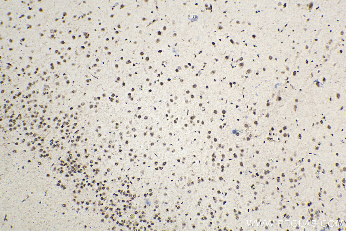 Immunohistochemical analysis of paraffin-embedded rat brain tissue slide using KHC1536 (TCF4 IHC Kit).