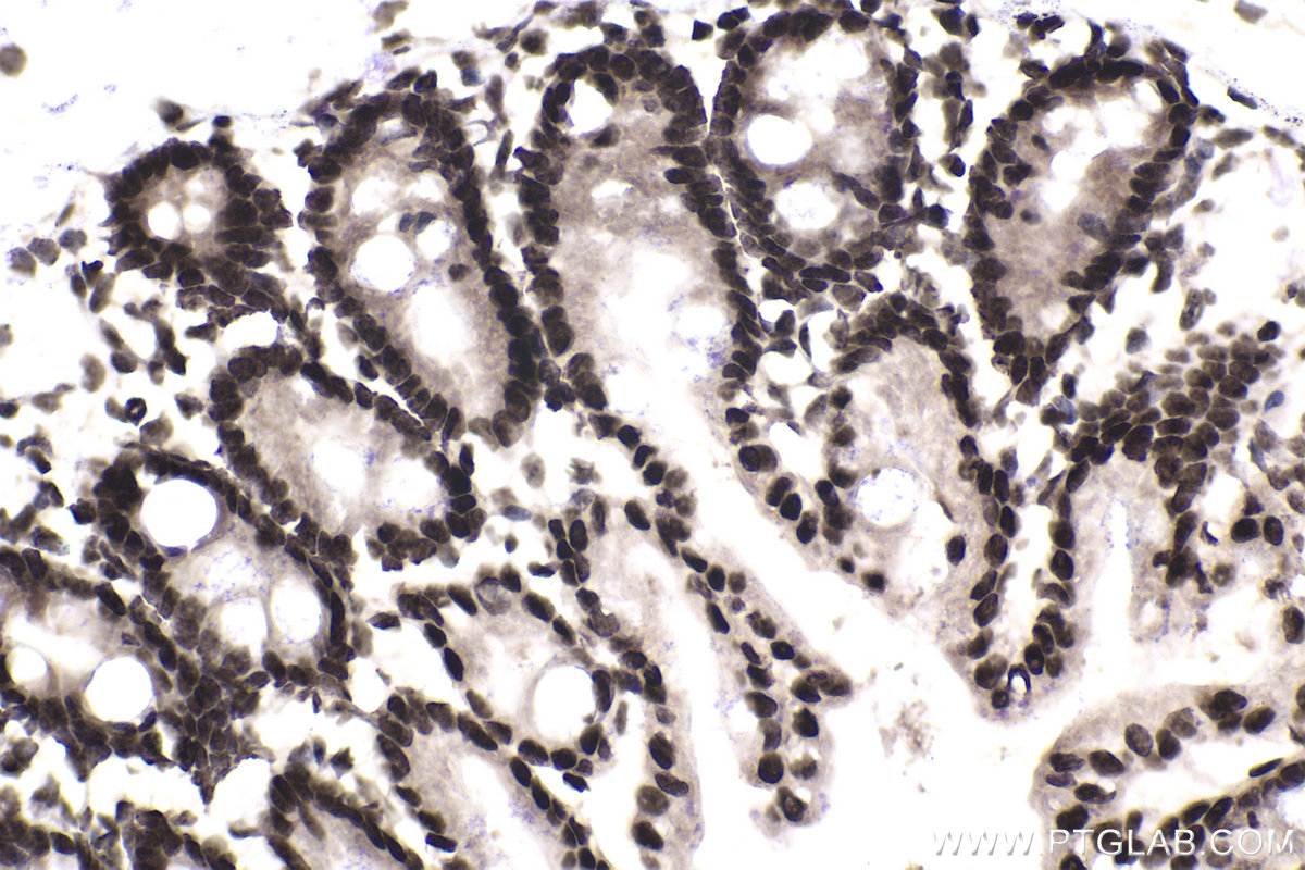 Immunohistochemical analysis of paraffin-embedded mouse intestine tissue slide using KHC1958 (TCF4/TCF7L2 IHC Kit).