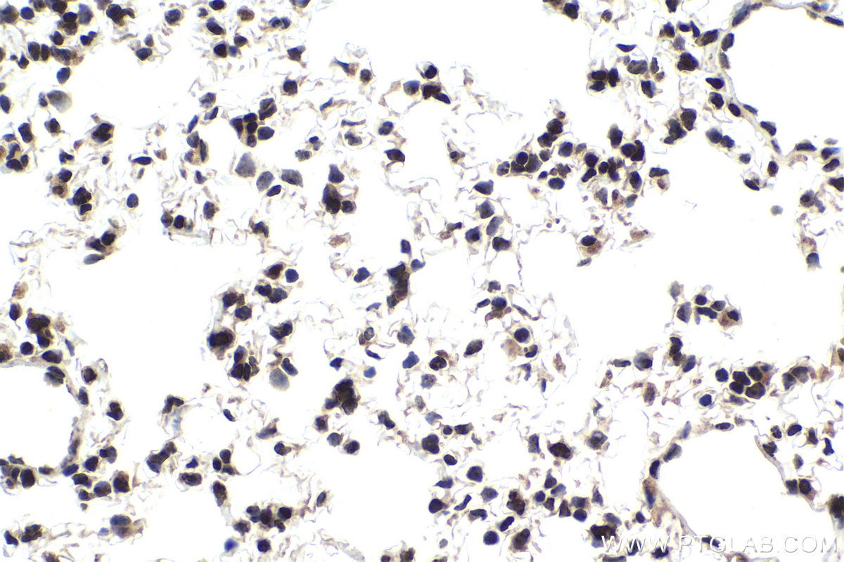 Immunohistochemical analysis of paraffin-embedded mouse lung tissue slide using KHC1958 (TCF4/TCF7L2 IHC Kit).