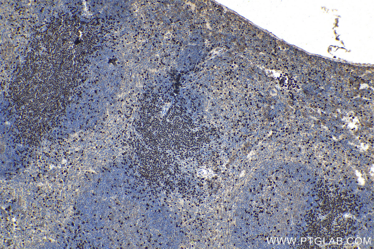 Immunohistochemical analysis of paraffin-embedded mouse spleen tissue slide using KHC1599 (TCF7 IHC Kit).