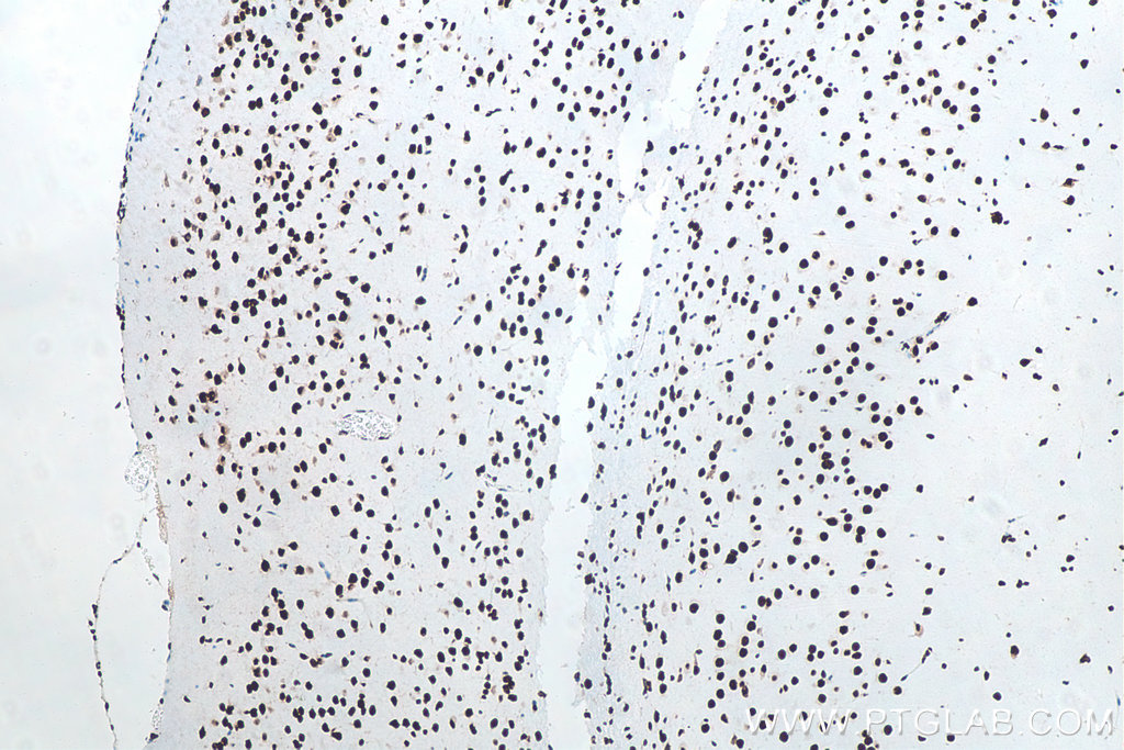 Immunohistochemical analysis of paraffin-embedded mouse brain tissue slide using KHC0001 (TDP-43 IHC Kit).