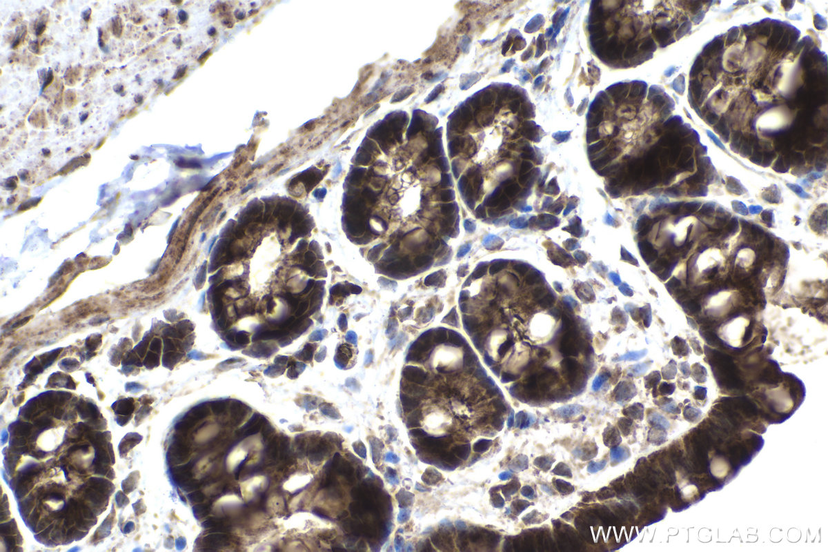 Immunohistochemical analysis of paraffin-embedded rat colon tissue slide using KHC1495 (TDP2 IHC Kit).