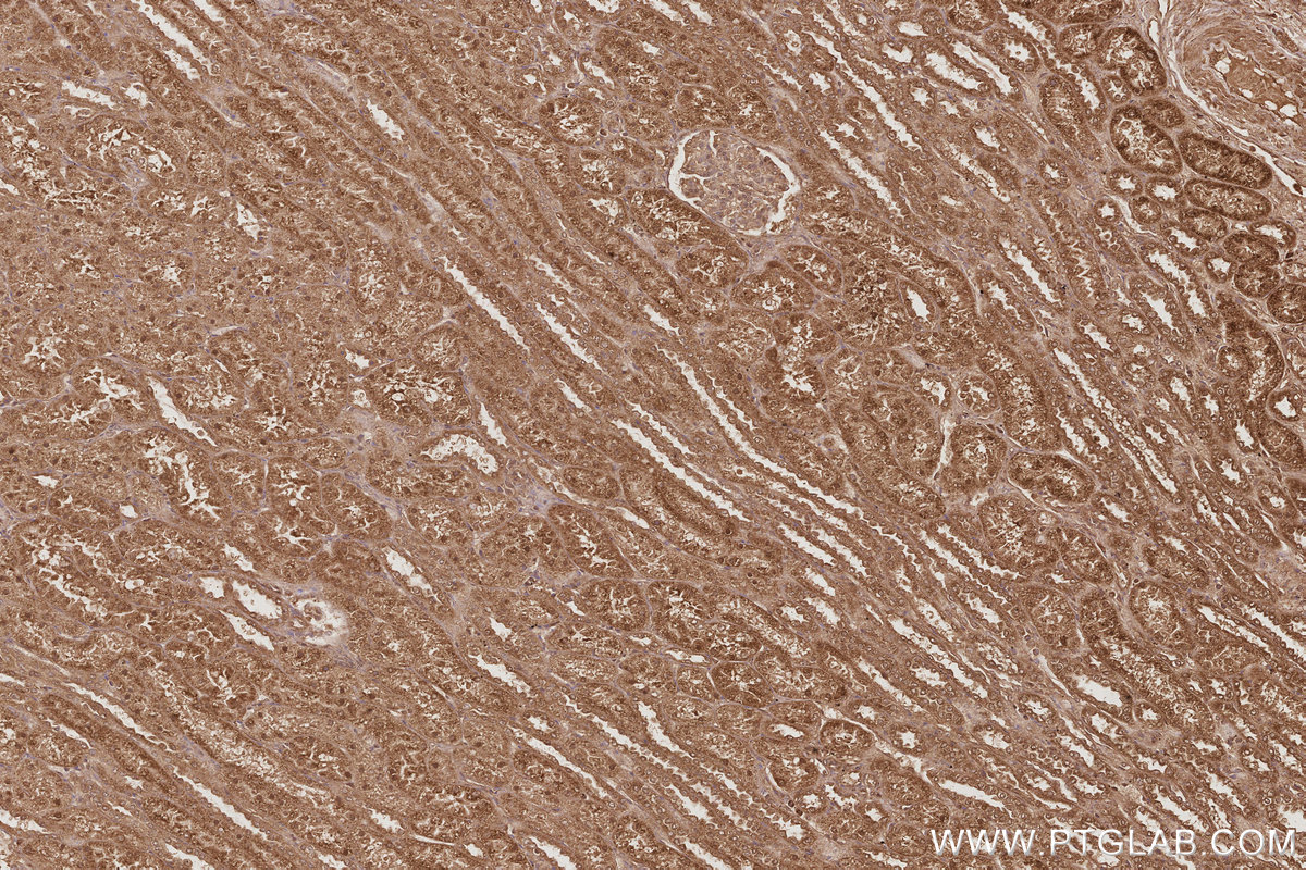 Immunohistochemical analysis of paraffin-embedded human kidney tissue slide using KHC3074 (TELO2 IHC Kit).