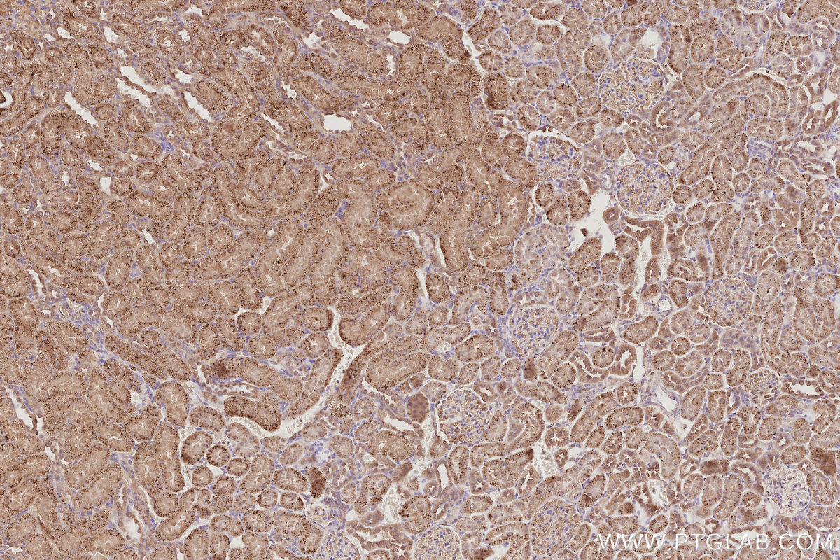 Immunohistochemical analysis of paraffin-embedded rat kidney tissue slide using KHC3074 (TELO2 IHC Kit).