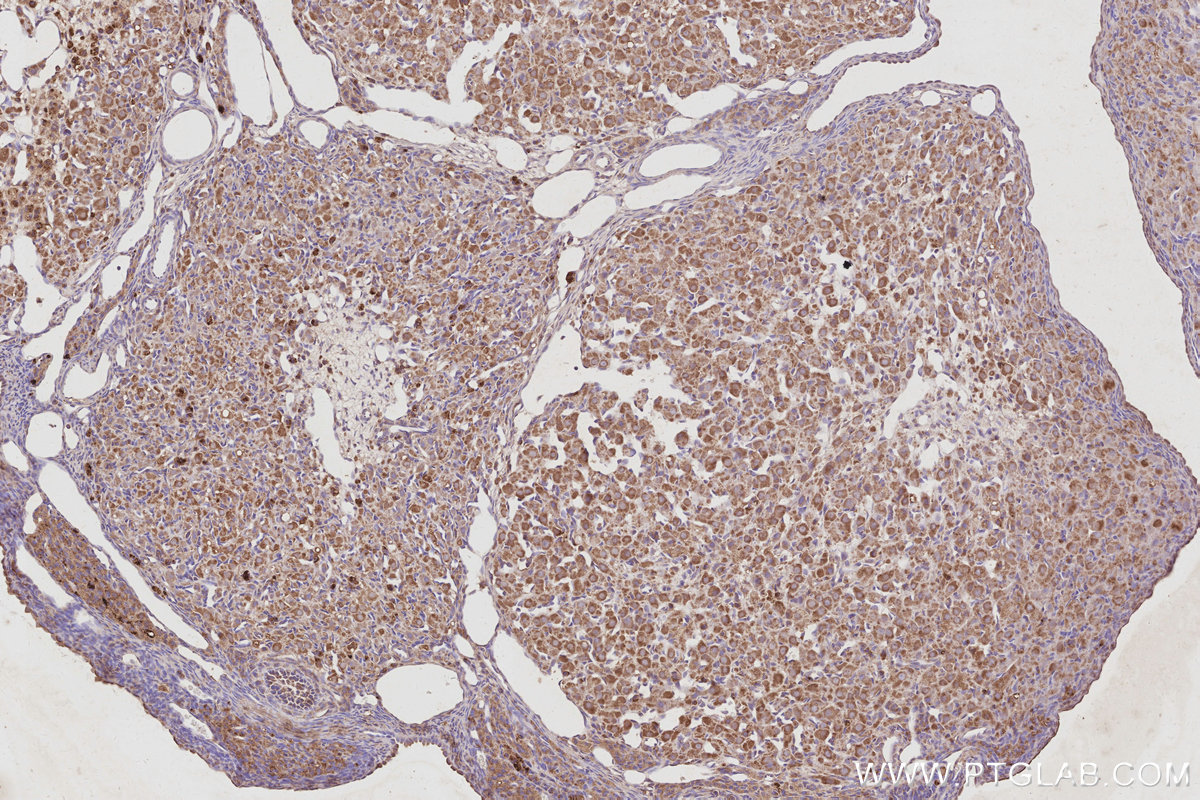 Immunohistochemical analysis of paraffin-embedded rat ovary tissue slide using KHC3074 (TELO2 IHC Kit).