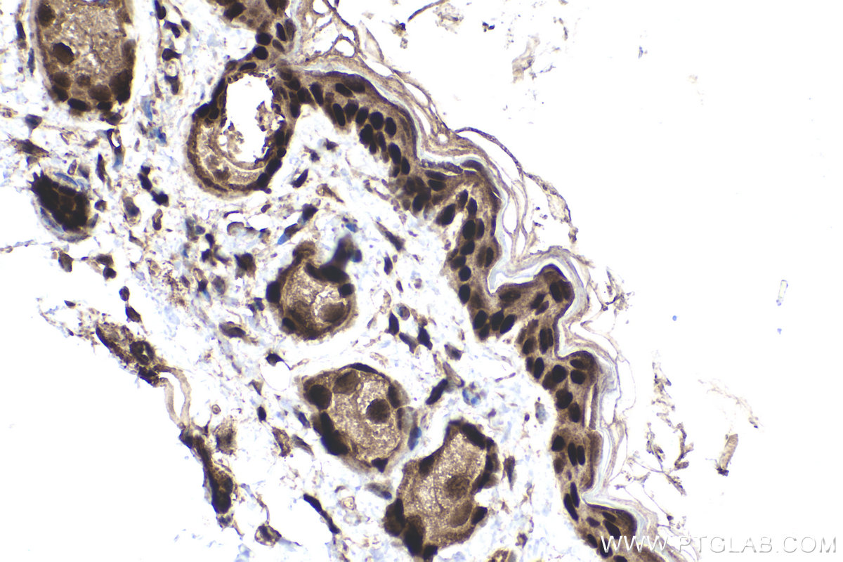 Immunohistochemical analysis of paraffin-embedded mouse skin tissue slide using KHC1852 (TFAP2C IHC Kit).