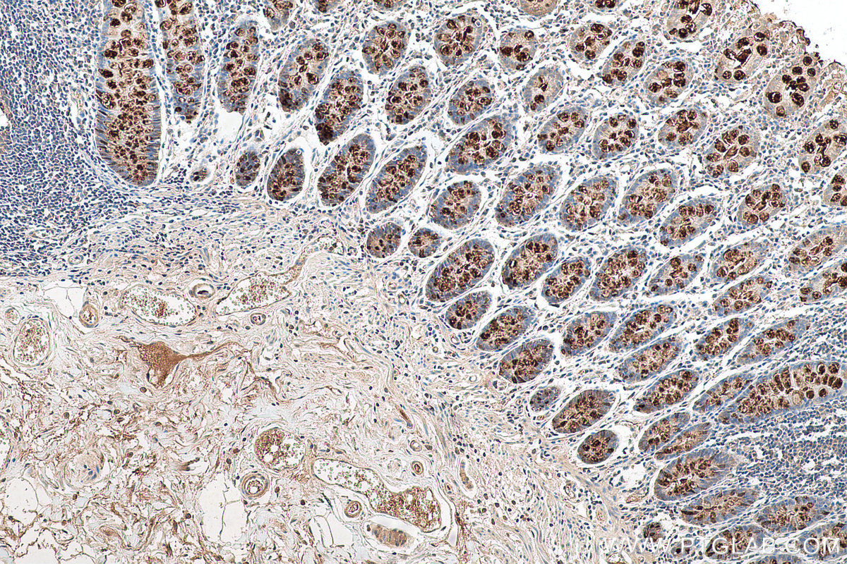 Immunohistochemical analysis of paraffin-embedded human colon tissue slide using KHC0648 (TFF3 IHC Kit).