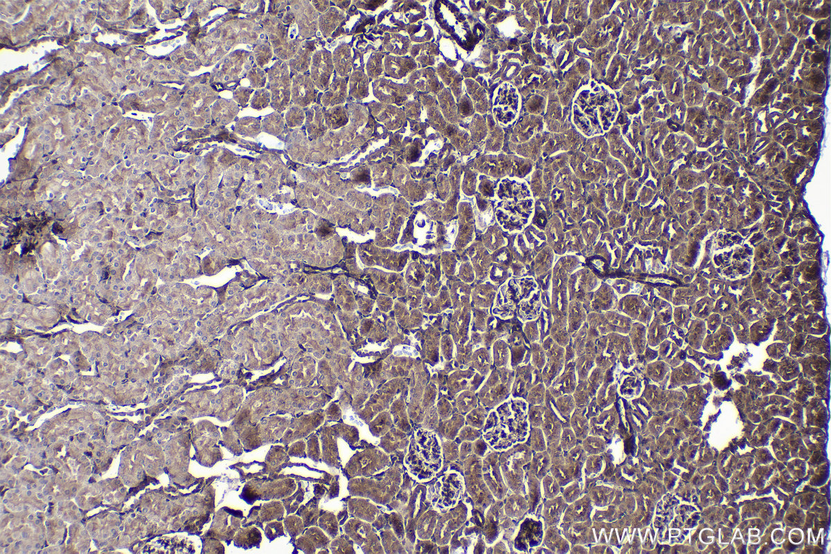 Immunohistochemical analysis of paraffin-embedded rat kidney tissue slide using KHC1453 (TGFB1I1/HIC5 IHC Kit).