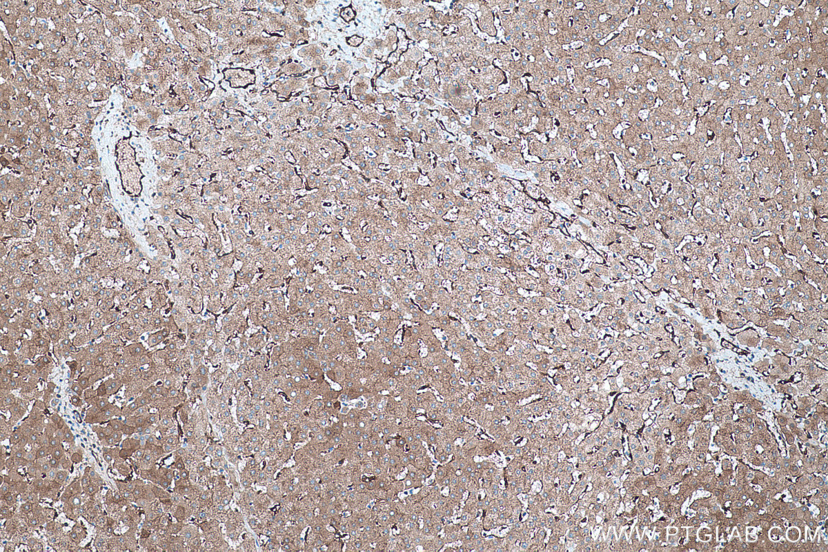 Immunohistochemical analysis of paraffin-embedded human liver tissue slide using KHC0467 (TGM2 IHC Kit).