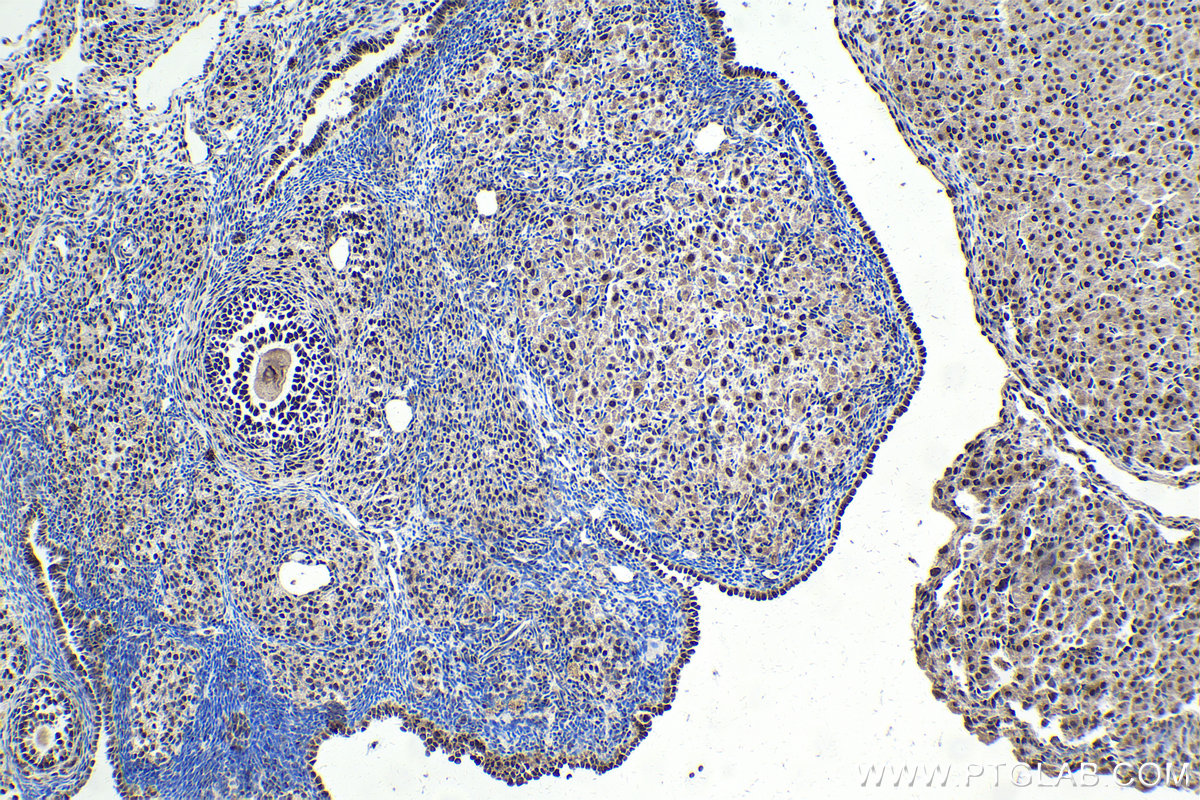 Immunohistochemical analysis of paraffin-embedded rat ovary tissue slide using KHC1719 (THOC5 IHC Kit).