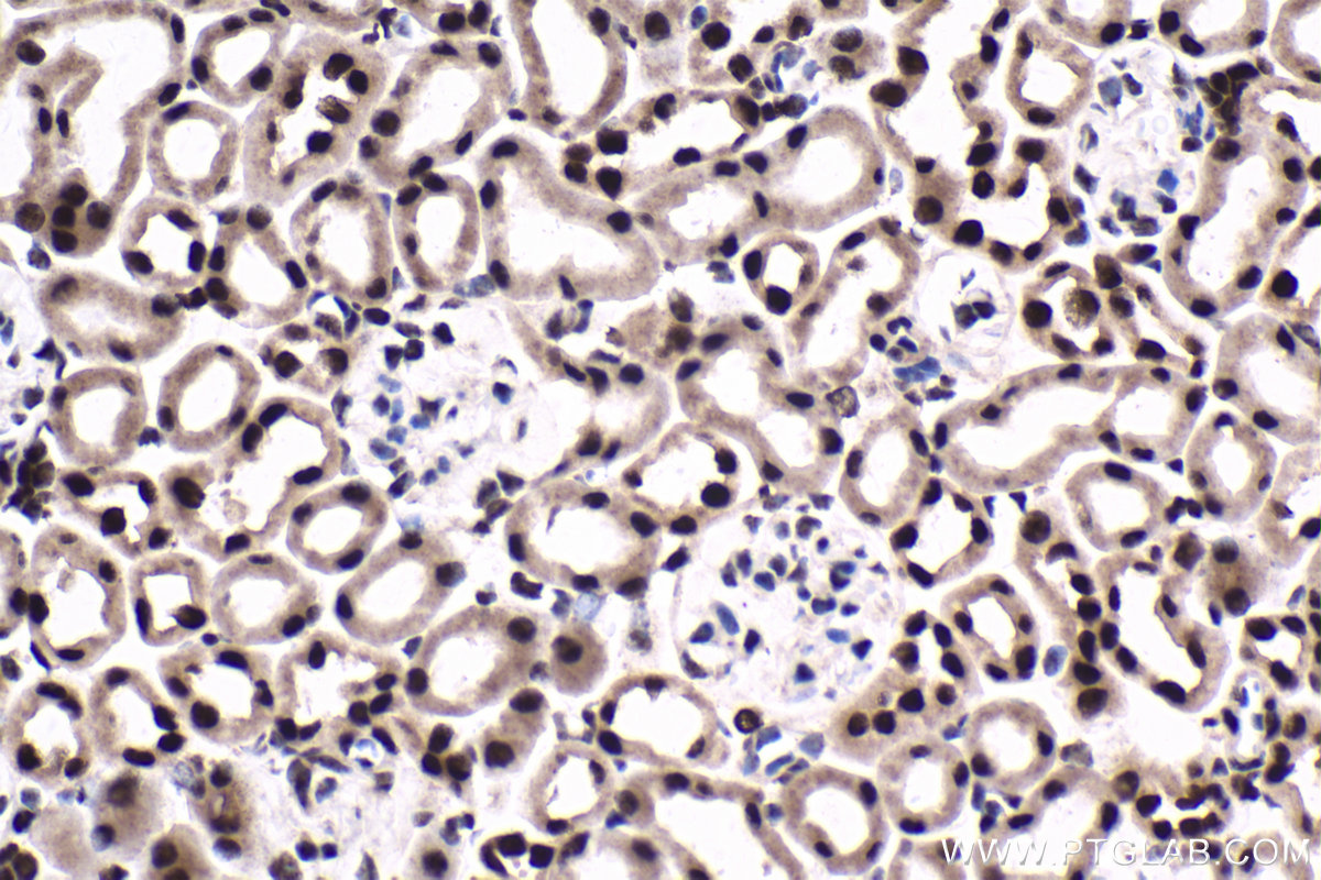 Immunohistochemical analysis of paraffin-embedded mouse kidney tissue slide using KHC1786 (THOC7 IHC Kit).