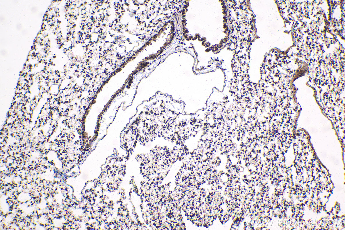 Immunohistochemical analysis of paraffin-embedded mouse lung tissue slide using KHC1786 (THOC7 IHC Kit).