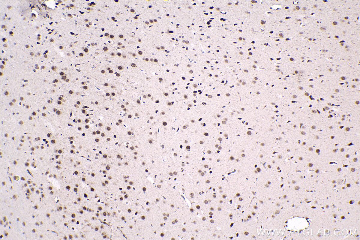 Immunohistochemical analysis of paraffin-embedded rat brain tissue slide using KHC1523 (THRA IHC Kit).