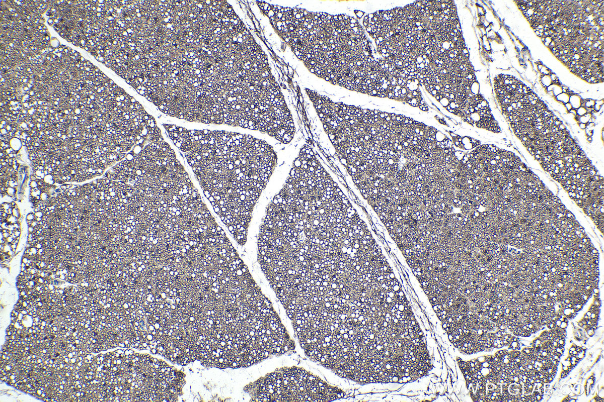 Immunohistochemical analysis of paraffin-embedded mouse brown adipose tissue slide using KHC1851 (THRSP IHC Kit).