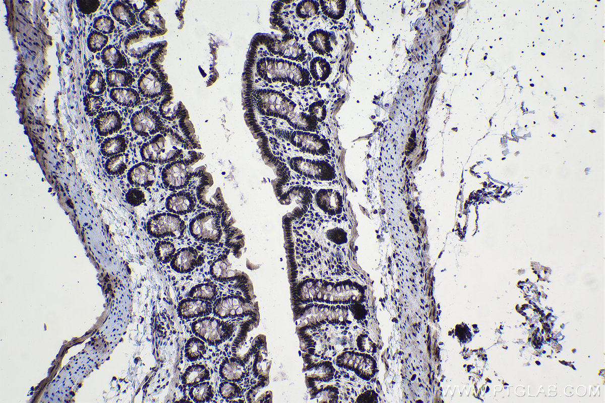 Immunohistochemical analysis of paraffin-embedded rat colon tissue slide using KHC0978 (THUMPD1 IHC Kit).