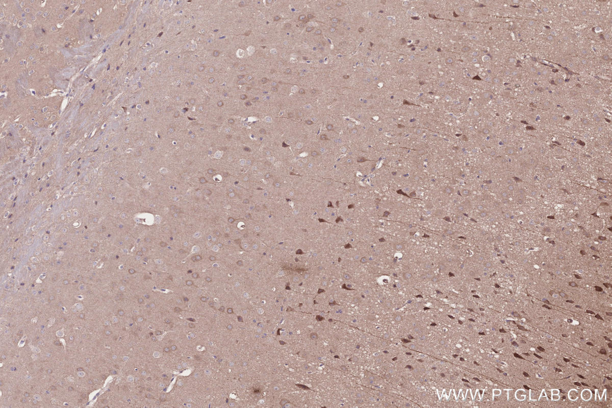 Immunohistochemical analysis of paraffin-embedded mouse brain tissue slide using KHC2645 (TIAM2 IHC Kit).