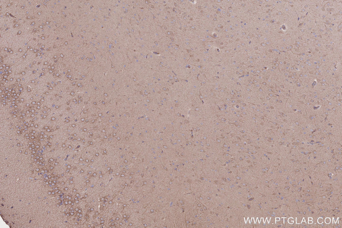 Immunohistochemical analysis of paraffin-embedded rat brain tissue slide using KHC2645 (TIAM2 IHC Kit).