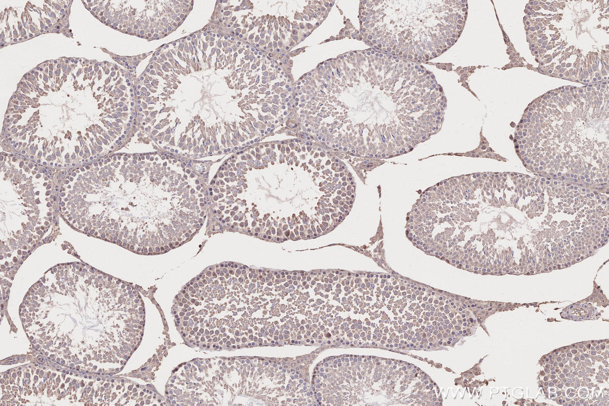 Immunohistochemical analysis of paraffin-embedded rat testis tissue slide using KHC2645 (TIAM2 IHC Kit).
