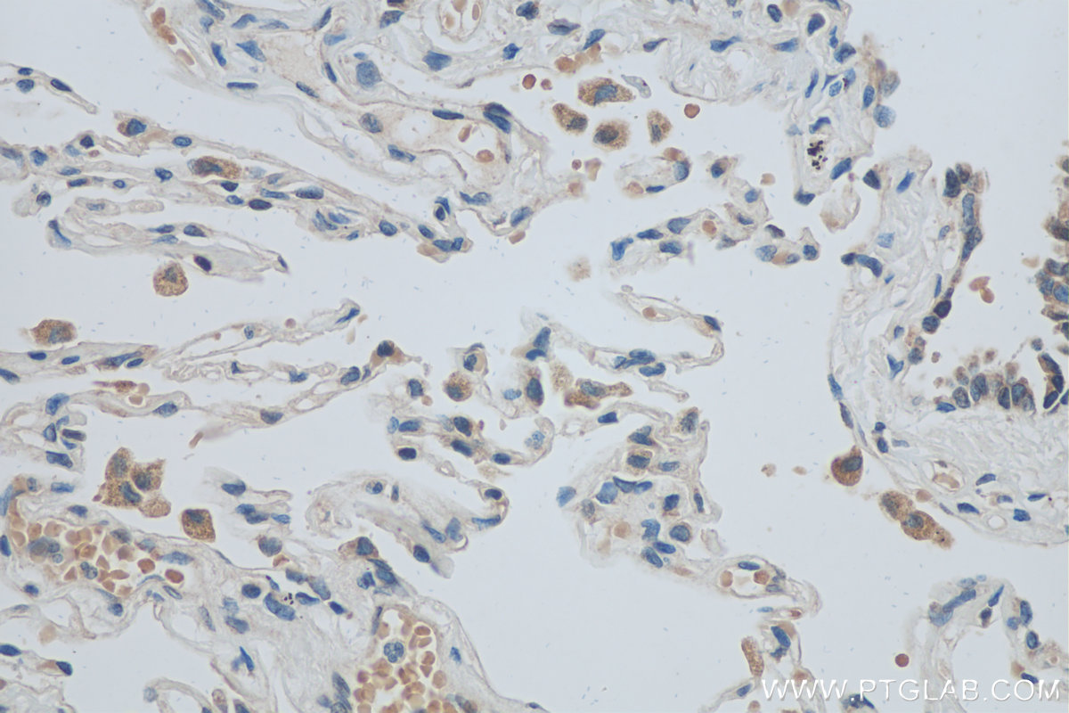 Immunohistochemical analysis of paraffin-embedded human lung tissue slide using KHC0495 (TIMD4 IHC Kit).