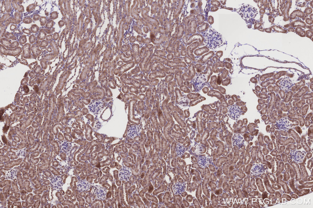 Immunohistochemical analysis of paraffin-embedded mouse kidney tissue slide using KHC3238 (TIMM10 IHC Kit).