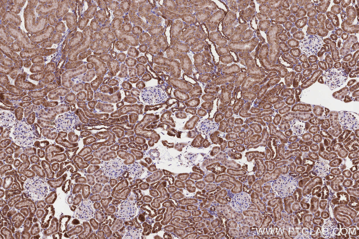 Immunohistochemical analysis of paraffin-embedded rat kidney tissue slide using KHC3238 (TIMM10 IHC Kit).