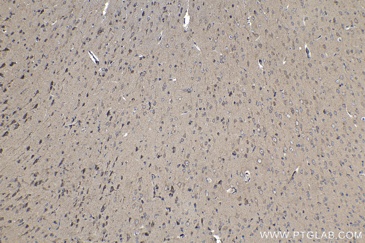 Immunohistochemical analysis of paraffin-embedded rat brain tissue slide using KHC1185 (TIMM17A IHC Kit).