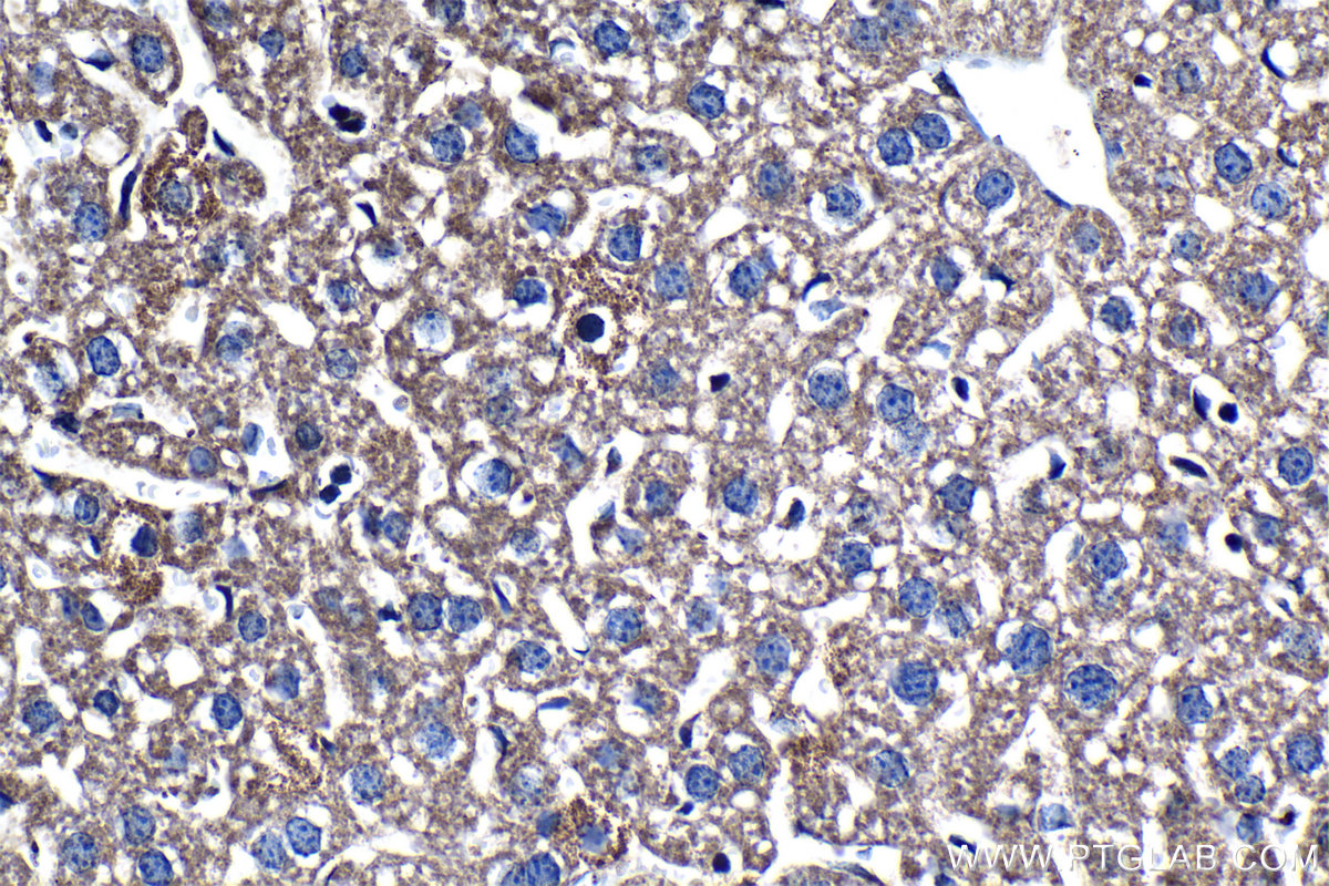 Immunohistochemical analysis of paraffin-embedded mouse liver tissue slide using KHC1304 (TIMM9 IHC Kit).