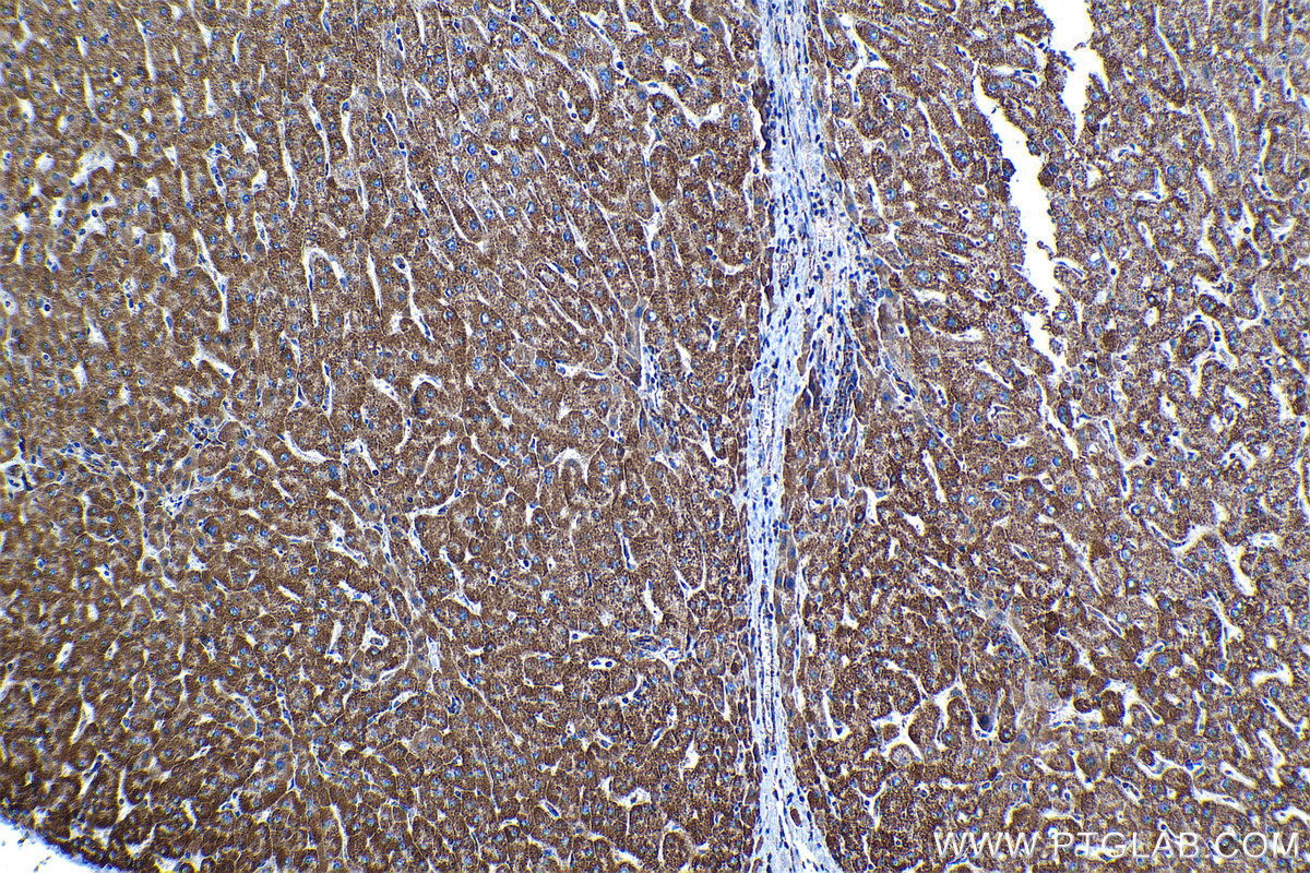 Immunohistochemical analysis of paraffin-embedded human liver tissue slide using KHC1304 (TIMM9 IHC Kit).