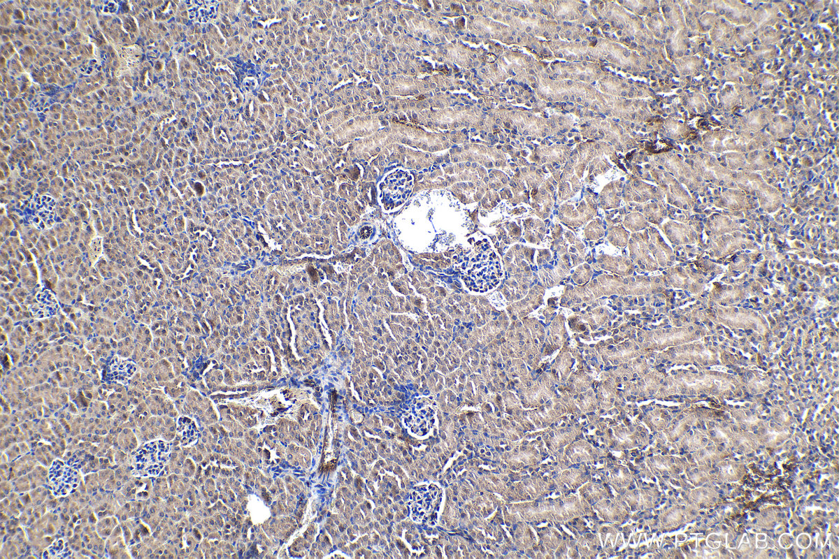 Immunohistochemical analysis of paraffin-embedded mouse kidney tissue slide using KHC1154 (TIMP2 IHC Kit).