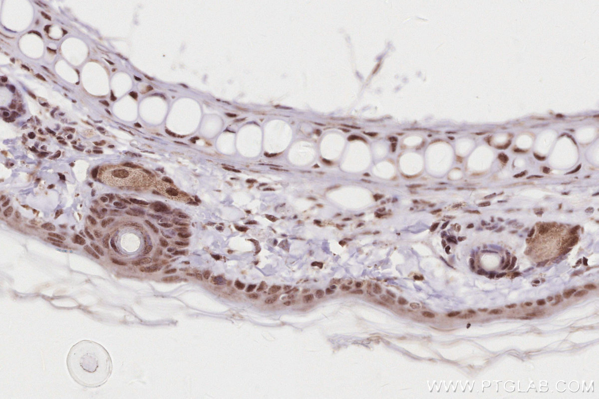 Immunohistochemical analysis of paraffin-embedded rat skin tissue slide using KHC2875 (TIPIN IHC Kit).
