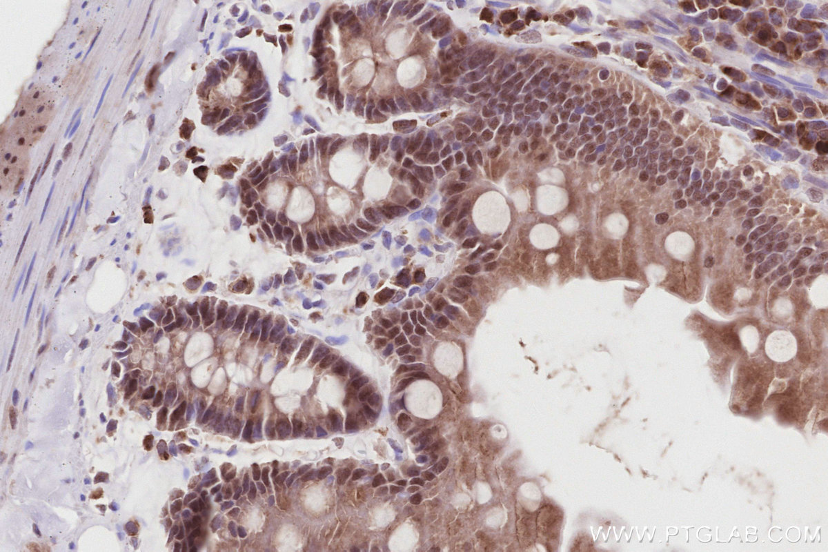 Immunohistochemical analysis of paraffin-embedded rat small intestine tissue slide using KHC2875 (TIPIN IHC Kit).