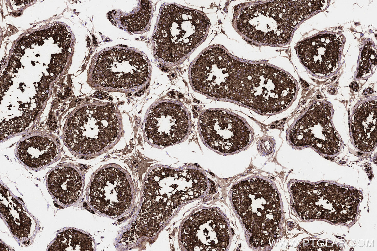 Immunohistochemical analysis of paraffin-embedded human testis tissue slide using KHC3224 (TKTL1 IHC Kit).
