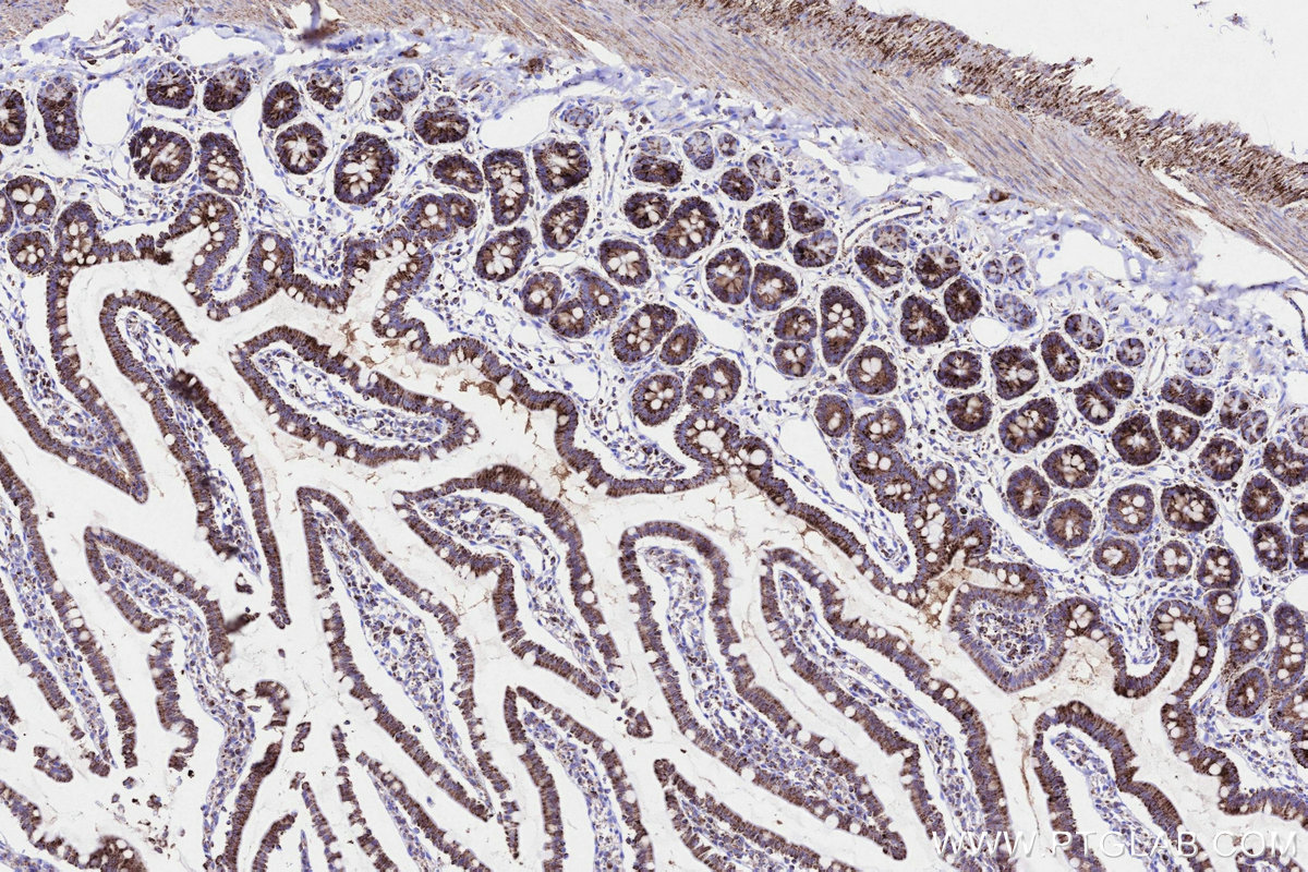 Immunohistochemical analysis of paraffin-embedded rat small intestine tissue slide using KHC3224 (TKTL1 IHC Kit).